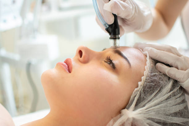 “Latest beauty treatments for acne scars and pigmentation”
